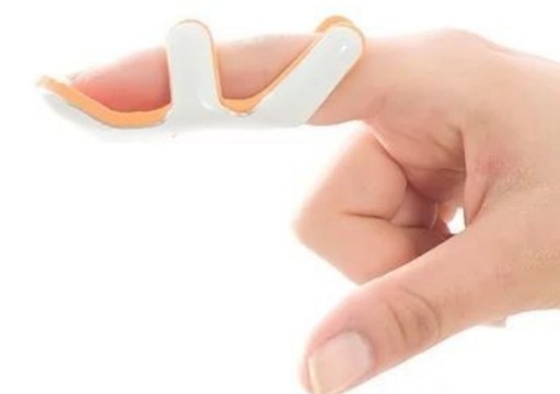 [64.001] frog splint 64.001